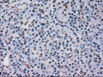 Anti-p38 gamma antibody [10E1] used in IHC (Paraffin sections) (IHC-P). GTX84148