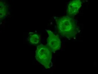 Anti-p38 beta antibody [1C2] used in Immunocytochemistry/ Immunofluorescence (ICC/IF). GTX84149