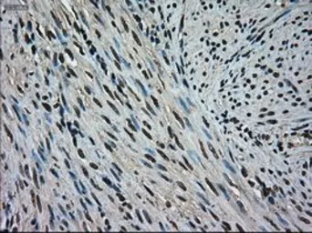 Anti-ERK2 antibody [6E5] used in IHC (Paraffin sections) (IHC-P). GTX84159