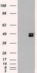 Anti-SEK1 / MKK4 antibody [4B4] used in Western Blot (WB). GTX84161