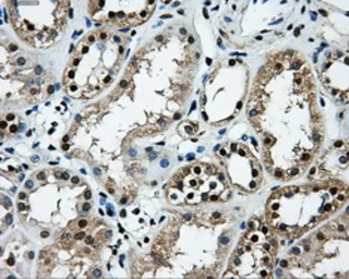 Anti-LOX antibody [6B11] used in IHC (Paraffin sections) (IHC-P). GTX84182