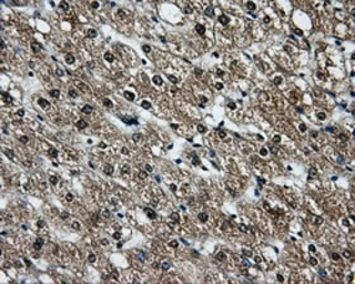 Anti-LOX antibody [6B11] used in IHC (Paraffin sections) (IHC-P). GTX84182