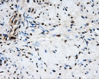 Anti-LOX antibody [6B11] used in IHC (Paraffin sections) (IHC-P). GTX84182