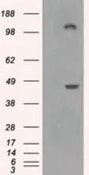 Anti-LOX antibody [5C4] used in Western Blot (WB). GTX84188