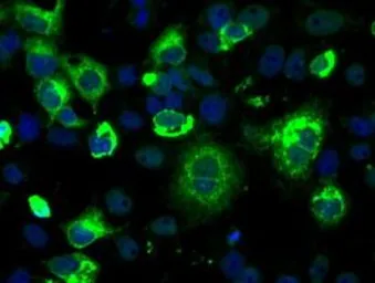 Anti-LOX antibody [9A11] used in Immunocytochemistry/ Immunofluorescence (ICC/IF). GTX84189