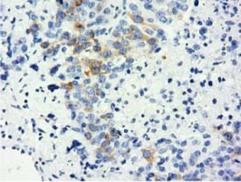 Anti-LIN7B antibody [1C9] used in IHC (Paraffin sections) (IHC-P). GTX84216