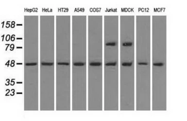 Anti-LEMD3 antibody [3H1] used in Western Blot (WB). GTX84221