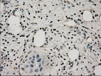 Anti-LDHA antibody [2D11] used in IHC (Paraffin sections) (IHC-P). GTX84227
