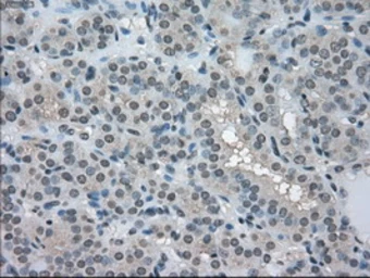 Anti-LDHA antibody [2D11] used in IHC (Paraffin sections) (IHC-P). GTX84227