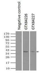 Anti-LDHA antibody [2D11] used in Immunoprecipitation (IP). GTX84227