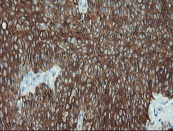 Anti-Cytokeratin 19 antibody [3F8] used in IHC (Paraffin sections) (IHC-P). GTX84251
