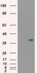 Anti-Cytokeratin 19 antibody [3F8] used in Western Blot (WB). GTX84251