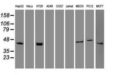 Anti-Cytokeratin 19 antibody [3F8] used in Western Blot (WB). GTX84251