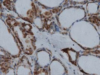 Anti-IVD antibody [1B10] used in IHC (Paraffin sections) (IHC-P). GTX84285