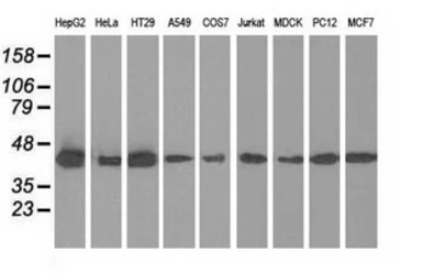 Anti-IVD antibody [1B10] used in Western Blot (WB). GTX84285