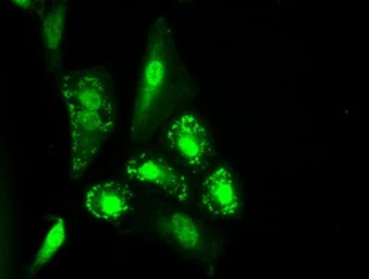 Anti-IL3 antibody [3B11] used in Immunocytochemistry/ Immunofluorescence (ICC/IF). GTX84295