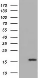 Anti-IL1F6 antibody [1D11] used in Western Blot (WB). GTX84299