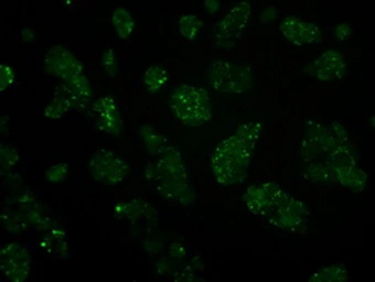 Anti-HIPPI antibody [2G3] used in Immunocytochemistry/ Immunofluorescence (ICC/IF). GTX84311