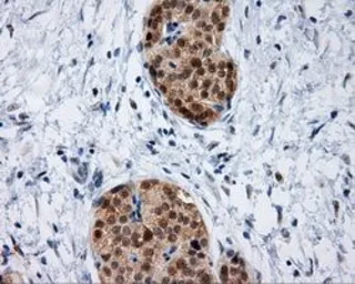 Anti-HIPPI antibody [2G3] used in IHC (Paraffin sections) (IHC-P). GTX84311