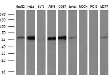 Anti-IFIT3 antibody [1G1] used in Western Blot (WB). GTX84314