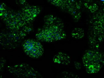 Anti-IDH3A antibody [2F11] used in Immunocytochemistry/ Immunofluorescence (ICC/IF). GTX84317