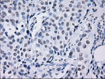 Anti-ID3 antibody [15F4] used in IHC (Paraffin sections) (IHC-P). GTX84320