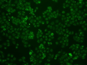 Anti-ID3 antibody [7B6] used in Immunocytochemistry/ Immunofluorescence (ICC/IF). GTX84327