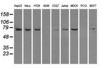 Anti-Hsp70 antibody [1B2] used in Western Blot (WB). GTX84337