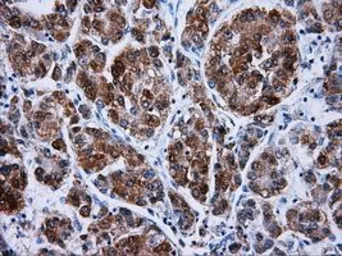 Anti-ERAB antibody [5E2] used in IHC (Paraffin sections) (IHC-P). GTX84344