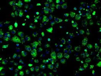 Anti-ERAB antibody [11A2] used in Immunocytochemistry/ Immunofluorescence (ICC/IF). GTX84347
