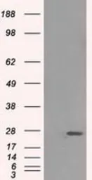 Anti-ERAB antibody [11A2] used in Western Blot (WB). GTX84347