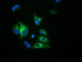 Anti-Haptoglobin antibody [4H5] used in Immunocytochemistry/ Immunofluorescence (ICC/IF). GTX84352