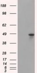 Anti-hnRNP F antibody [5F5] used in Western Blot (WB). GTX84356