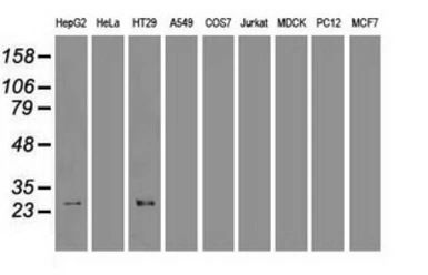 Anti-Hex antibody [3E6] used in Western Blot (WB). GTX84374