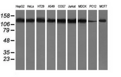 Anti-HDAC6 antibody [4C5] used in Western Blot (WB). GTX84377
