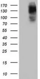 Anti-HDAC6 antibody [1D11] used in Western Blot (WB). GTX84379