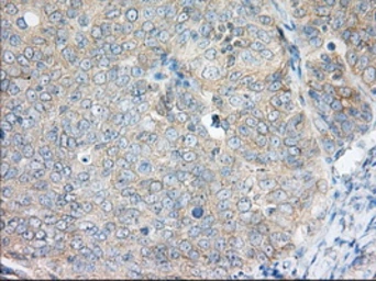Anti-H6PD antibody [1H6] used in IHC (Paraffin sections) (IHC-P). GTX84394