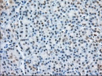 Anti-H6PD antibody [2A7] used in IHC (Paraffin sections) (IHC-P). GTX84395