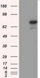 Anti-H6PD antibody [2A7] used in Western Blot (WB). GTX84395