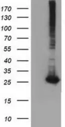 Anti-GSTT2 antibody [8A10] used in Western Blot (WB). GTX84398