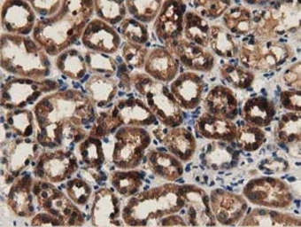 Anti-GSTT2 antibody [2E3] used in IHC (Paraffin sections) (IHC-P). GTX84400
