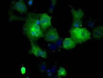 Anti-GBE1 antibody [1D11] used in Immunocytochemistry/ Immunofluorescence (ICC/IF). GTX84452