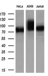 Anti-GBE1 antibody [3C8] used in Western Blot (WB). GTX84454