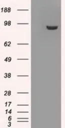 Anti-GBE1 antibody [3C8] used in Western Blot (WB). GTX84454