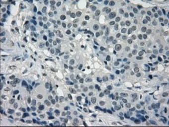 Anti-FRK antibody [6D2] used in IHC (Paraffin sections) (IHC-P). GTX84481