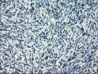 Anti-FRK antibody [6D2] used in IHC (Paraffin sections) (IHC-P). GTX84481