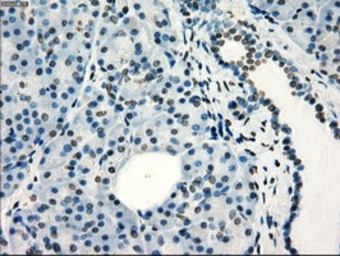 Anti-FRK antibody [6D2] used in IHC (Paraffin sections) (IHC-P). GTX84481