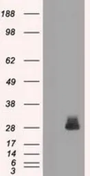 Anti-FRA1 antibody [12F9] used in Western Blot (WB). GTX84488