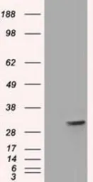 Anti-FHL1 antibody [1D6] used in Western Blot (WB). GTX84495