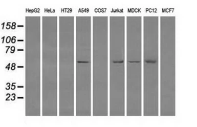 Anti-Fumarate hydratase antibody [9G4] used in Western Blot (WB). GTX84498